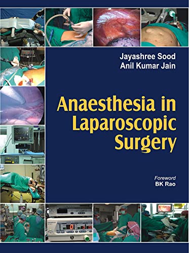 Anaesthesia in Laparoscopic Surgery - Click to Buy