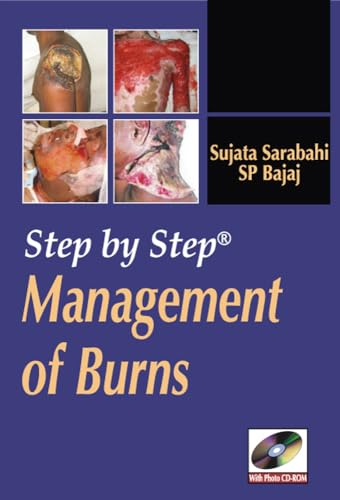 Step by Step Management of Burns - Click to Buy