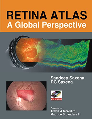 Retina Atlas: A Global Perspective - Click to Buy