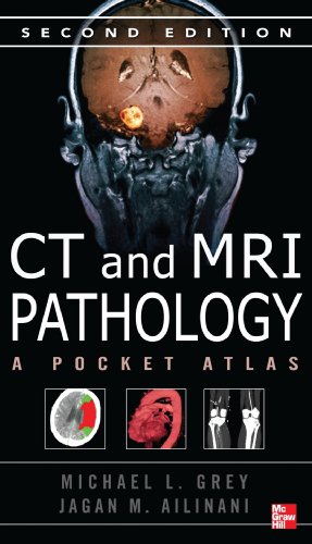 CT & MRI Pathology: A Pocket Atlas, Second Edition