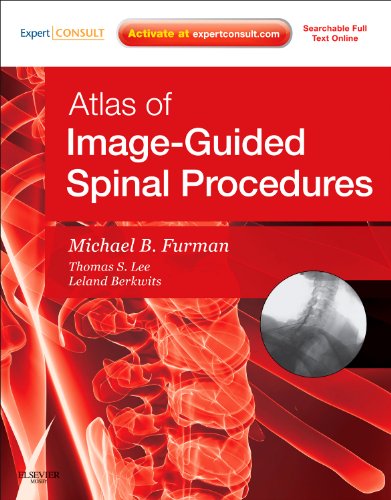 Atlas of Image-Guided Spinal Procedures - Click to Buy