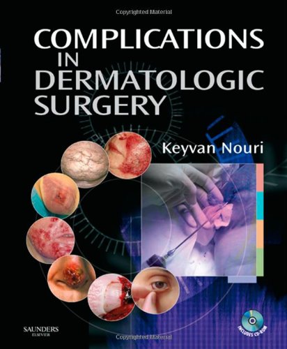 Complications in Dermatologic Surgery - Click to Buy