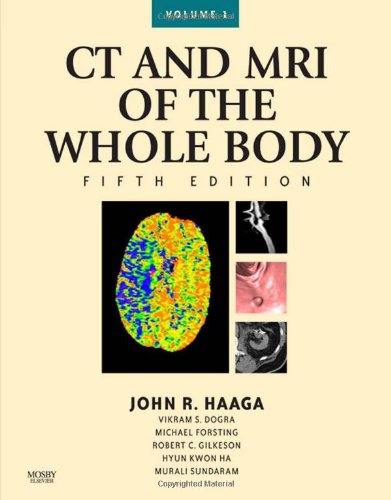 CT and Mri of the Whole Body, 2-Volume Set - Click to Buy