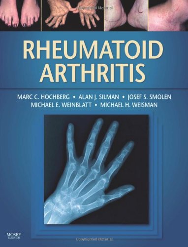 Rheumatoid Arthritis - Click to Buy