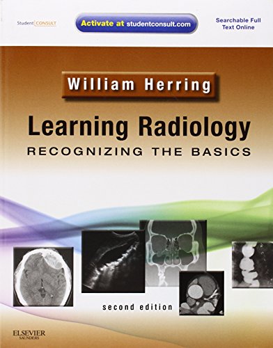 Learning Radiology: Recognizing the Basics (With STUDENT CONSULT Online Access) - Click to Buy