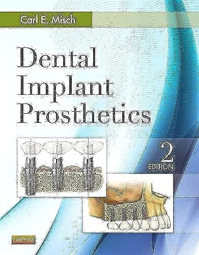Dental Implant Prosthetics 2Ed (Hb 2015) - Click to Buy