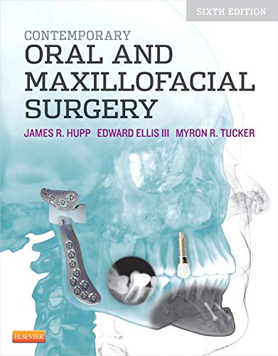 Contemporary Oral and Maxillofacial Surgery - Click to Buy
