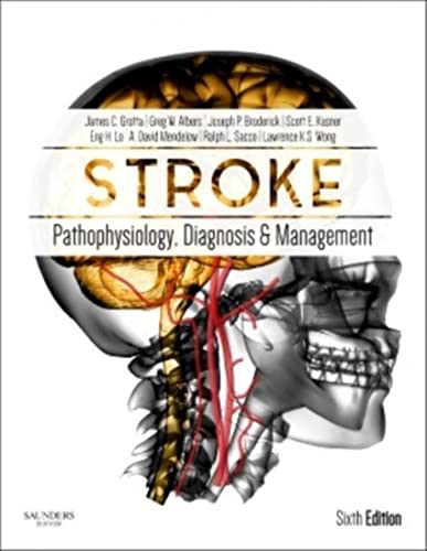 Stroke: Pathophysiology, Diagnosis, and Management - Click to Buy