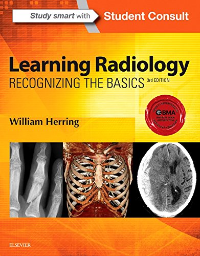 Learning Radiology: Recognizing the Basics - Click to Buy