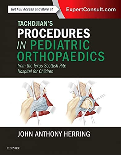 Tachdjian's Procedures in Pediatric Orthopaedics: From the Texas Scottish Rite Hospital for Children - Click to Buy