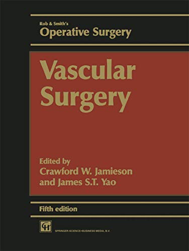 ROB & SMITH'S OPERATIVE SURGERY:VASCULAR SURGERY, 5/ED: 14 (Rob & Smith's Operative Surgery Series) - Click to Buy