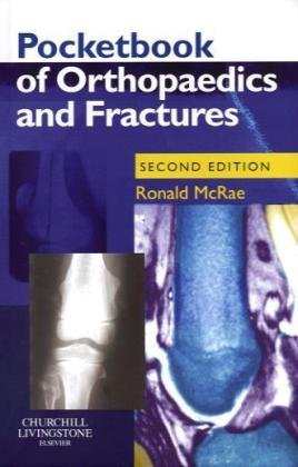 Pocketbook of Orthopaedics and Fractures