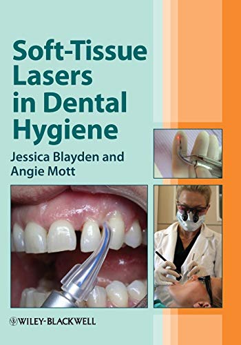 Soft-Tissue Lasers in Dental Hygiene - Click to Buy