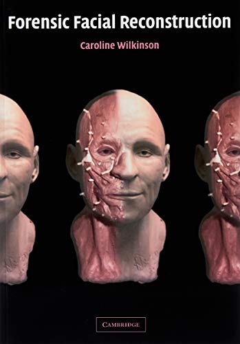 Forensic Facial Reconstruction - Click to Buy