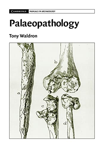 PALAEOPATHOLOGY - Click to Buy
