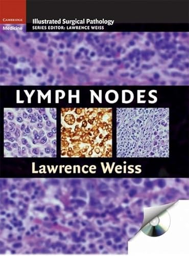 Lymph Nodes (Cambridge Illustrated Surgical Pathology)