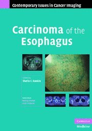 Carcinoma of the Esophagus (Contemporary Issues in Cancer Imaging)