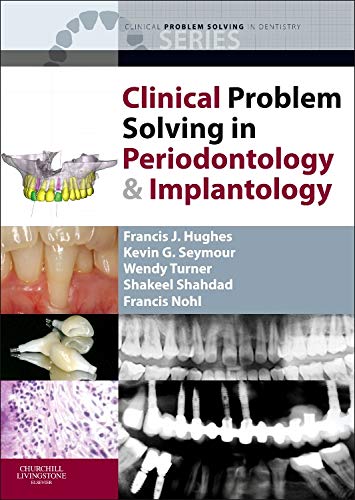 Clinical Problem Solving in Periodontology and Implantology - Click to Buy