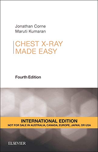 Chest X-Ray Made Easy, International Edition - Click to Buy