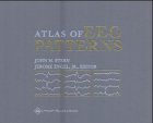 An Atlas of EEG Patterns