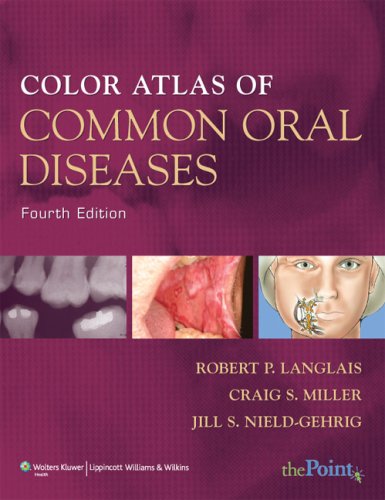 Color Atlas of Common Oral Diseases - Click to Buy