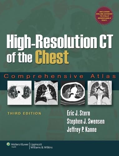 High-Resolution CT of the Chest: Comprehensive Atlas - Click to Buy