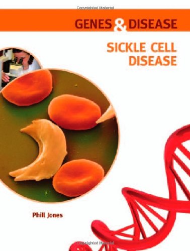 Sickle Cell Disease (Genes and Disease) - Click to Buy