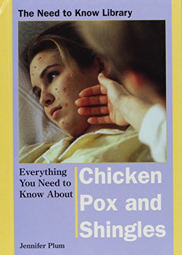 Everything You Need to Know about Chicken Pox and Shingles - Click to Buy
