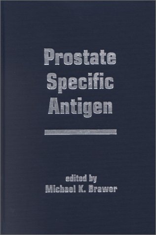 Prostate Specific Antigen - Click to Buy