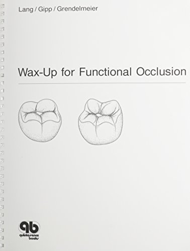 Wax-Up for Functional Occlusion: According to the Principles of Freedom in Centric - Click to Buy