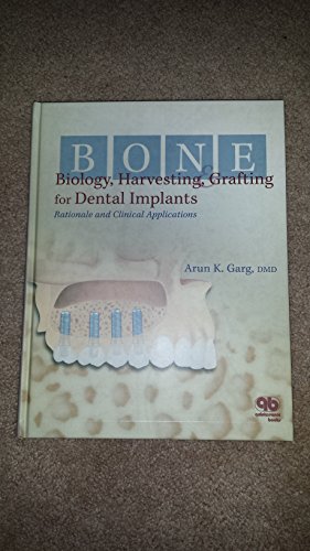 Bone Biology, Harvesting, & Grafting For Dental Implants: Rationale and Clinical Applications - Click to Buy