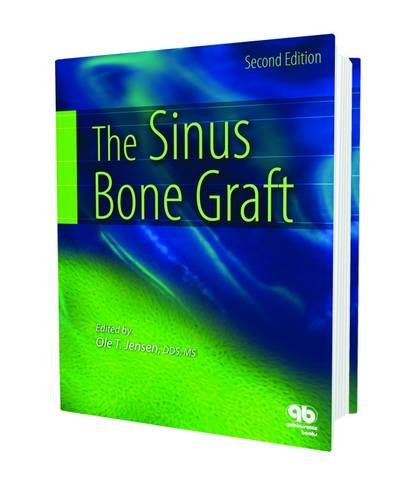 The Sinus Bone Graft - Click to Buy