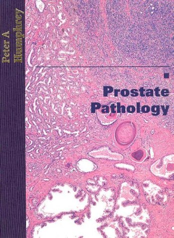 Prostate Pathology - Click to Buy