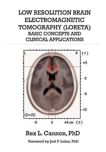 Low Resolution Brain Electromagnetic Tomography (LORETA): Basic Concepts and Clinical Applications - Click to Buy