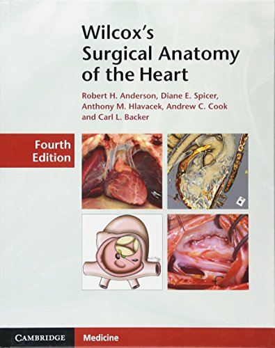Wilcox's Surgical Anatomy of the Heart - Click to Buy