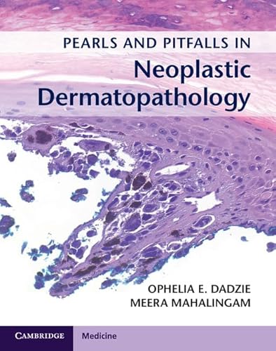 Pearls and Pitfalls in Neoplastic Dermatopathology with Online Access - Click to Buy