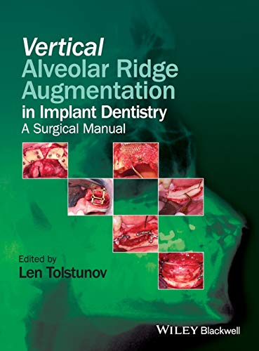 Vertical Alveolar Ridge Augmentation in Implant Dentistry: A Surgical Manual - Click to Buy