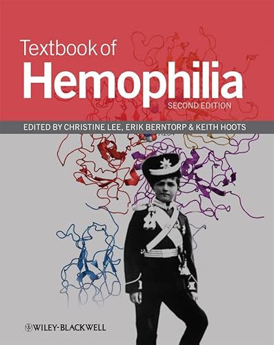 Textbook of Hemophilia - Click to Buy