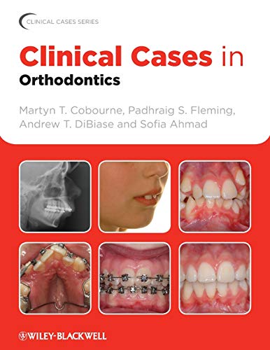 Clinical Cases in Orthodontics - Click to Buy