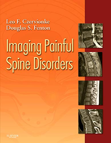 Imaging Painful Spine Disorders - Click to Buy
