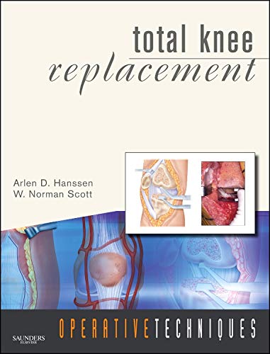 Total Knee Replacement - Click to Buy