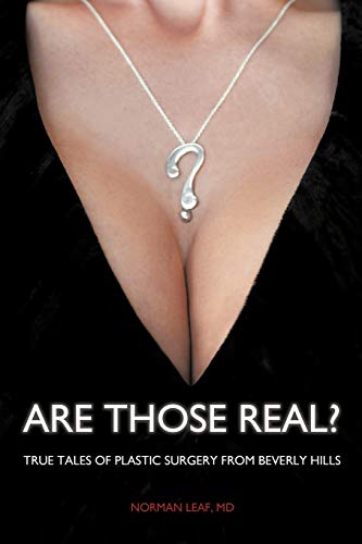 Are Those Real?: True Tales of Plastic Surgery from Beverly Hills