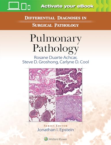 Differential Diagnoses in Surgical Pathology: Pulmonary Pathology - Click to Buy