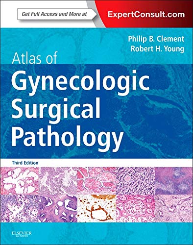 Atlas of Gynecologic Surgical Pathology: Expert Consult: Online and Print - Click to Buy