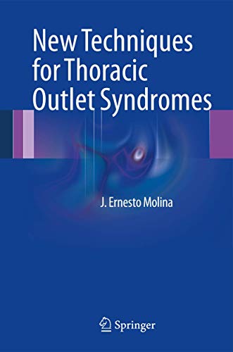 New Techniques for Thoracic Outlet Syndromes - Click to Buy