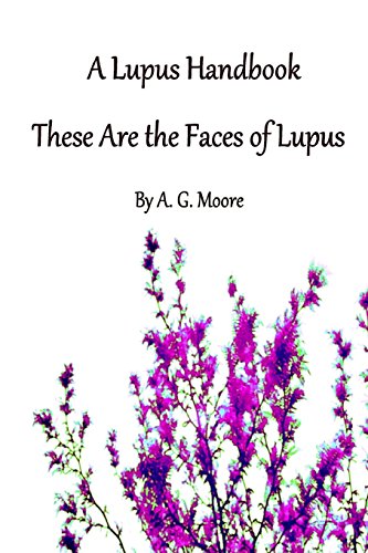 A Lupus Handbook: These Are The Faces Of Lupus - Click to Buy