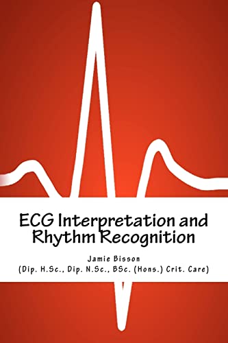 ECG Interpretation and Rhythm Recognition - Click to Buy