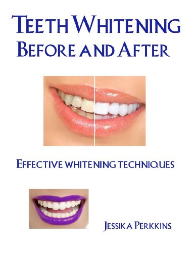 Teeth Whitening Before and After: Effective whitening techniques - Click to Buy