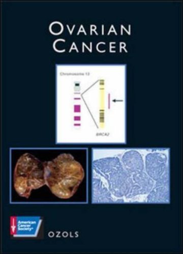 Ovarian Cancer: American Cancer Society Atlas of Clinical Oncology - Click to Buy