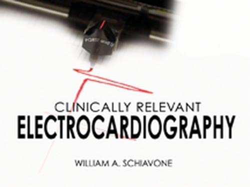 Clinically Relevant Electrocardiography: PQRST and U - Click to Buy